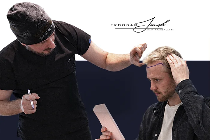 Hair Transplant